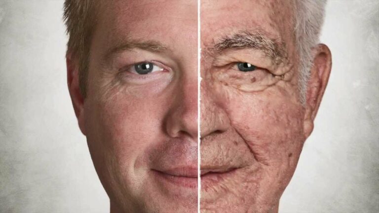 The skin structure and function are changed when a person ages!